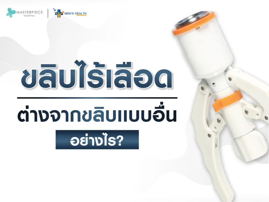 ขลิบไร้เลือดต่างจากขลิบแบบอื่นอย่างไร