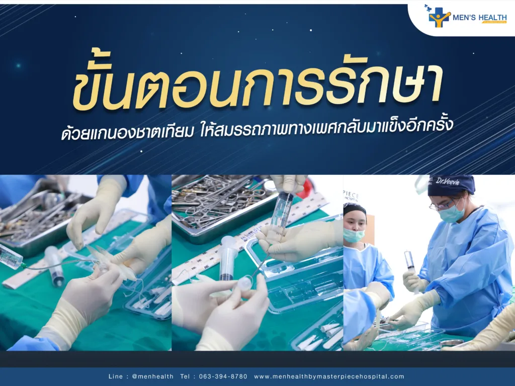 ขั้นตอนการใส่แกนองคชาติเทียม หมอวี