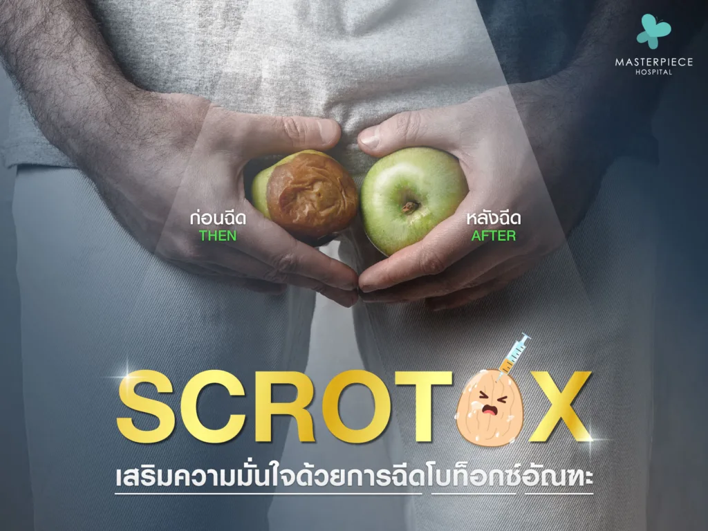 Scrotox เสริมความมั่นใจด้วยการฉีดโบท็อกซ์อัณฑะ