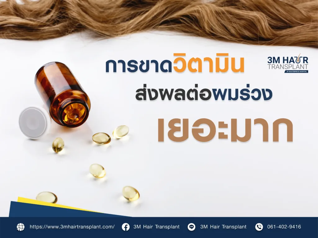การขาดวิตามินส่งผลต่อผมร่วงเยอะมาก