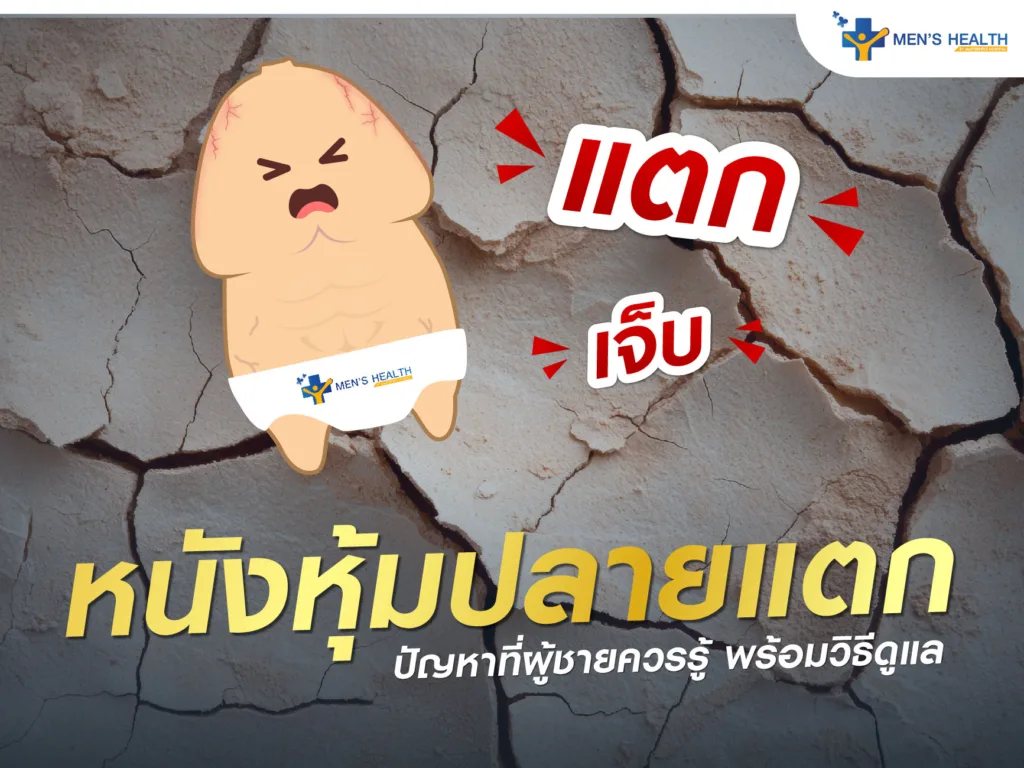 หนังหุ้มปลายแตก ปัญหาที่ผู้ชายควรรู้ พร้อมวิธีดูแลให้ถูกวิธี
