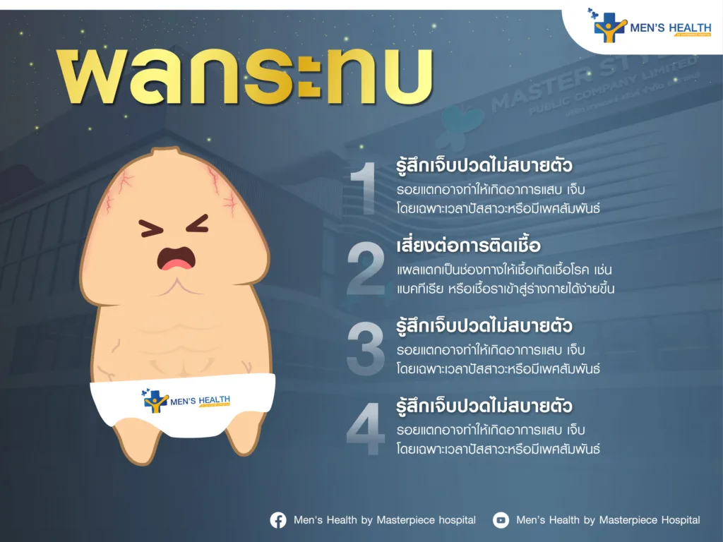 ผลกระทบจากอาการหนังหุ้มปลายแตก